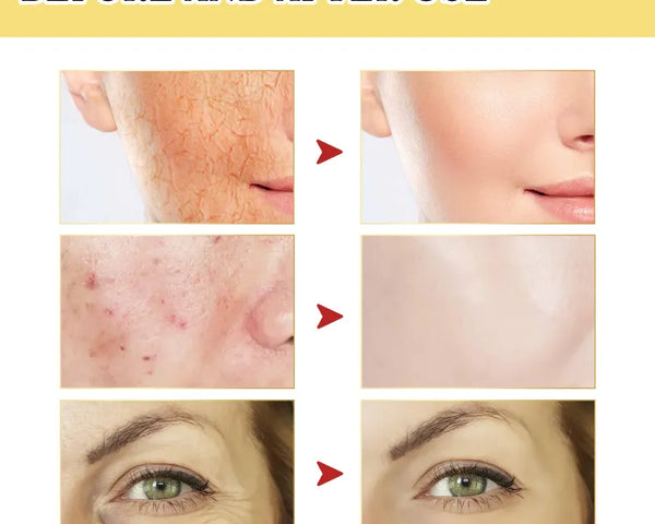 Collagen Power Repairing Liquid